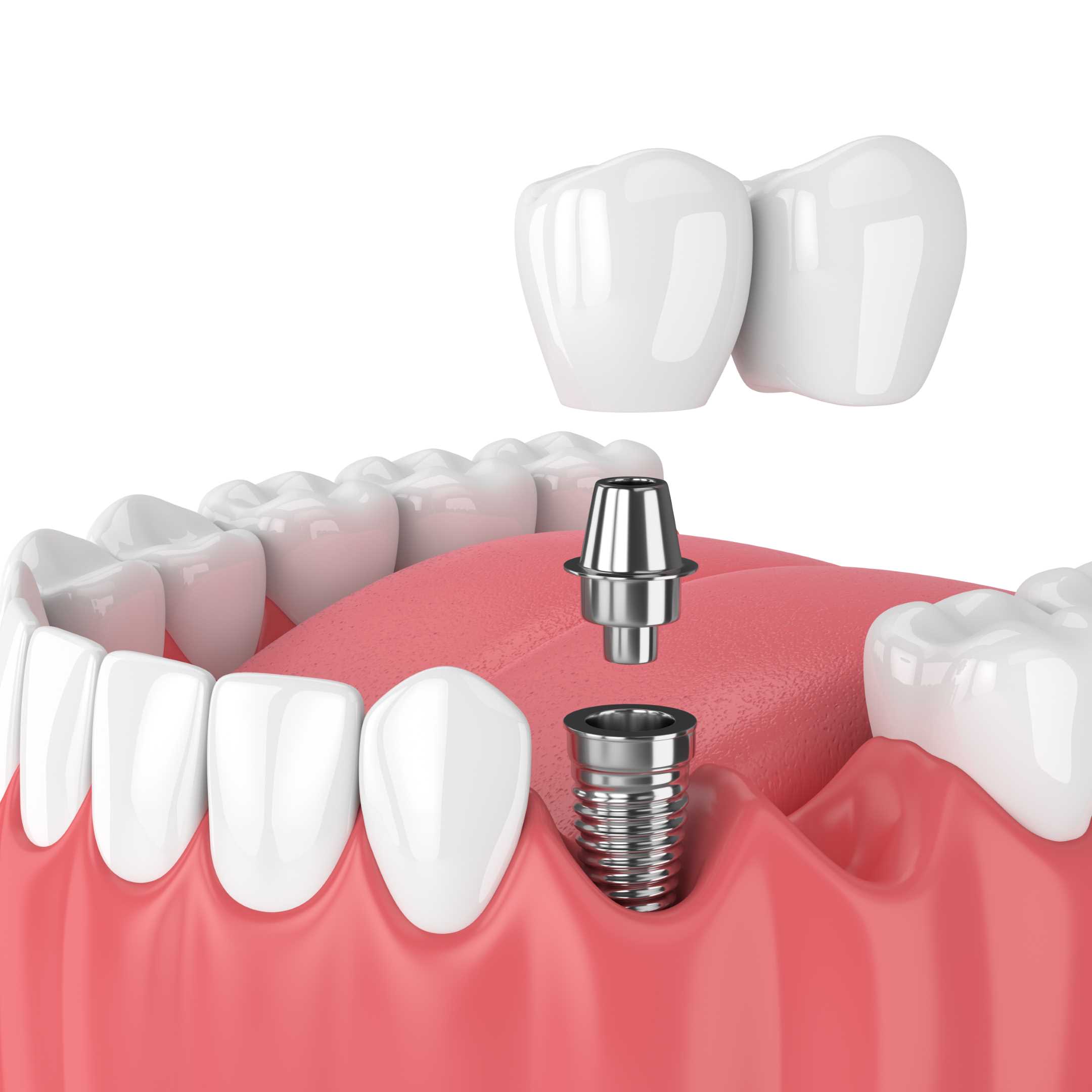 Dental treatment in progress